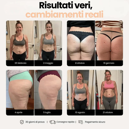 Leggings 3D Anticellulite